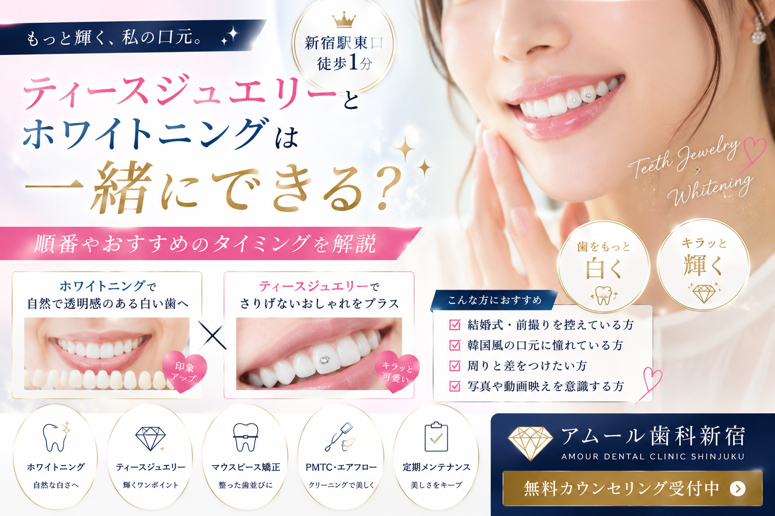 ティースジュエリーとホワイトニングは一緒にできる？順番やおすすめのタイミングを歯科医院が解説【アムール歯科新宿】