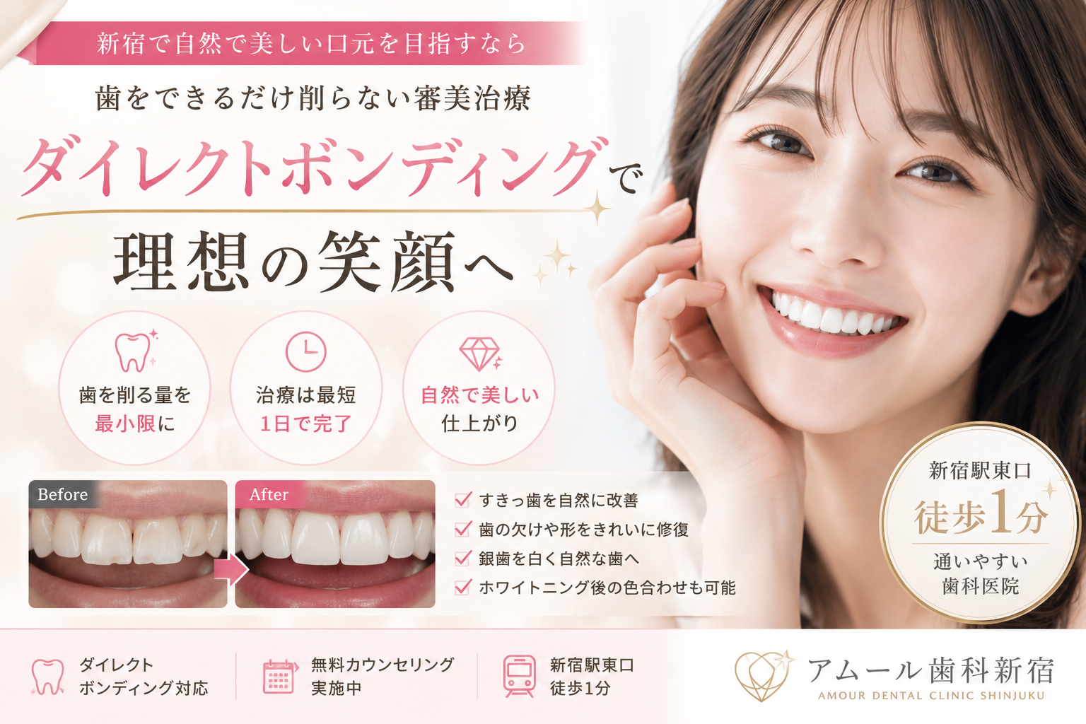 新宿でダイレクトボンディングをご検討の方へ|歯をできるだけ削らず、美しく自然な口元へ