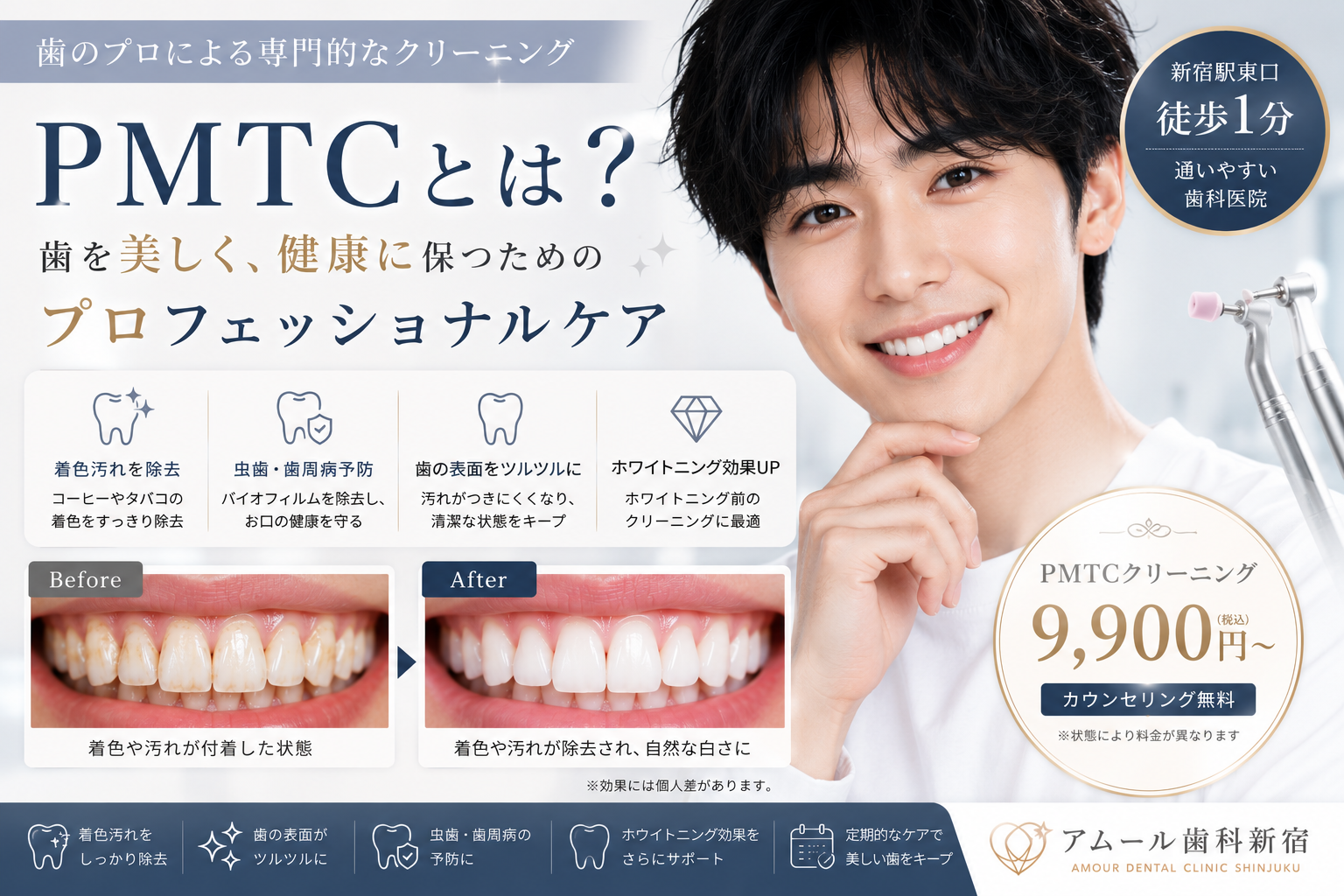 PMTCとは？歯科医院で受けるプロのクリーニングで健康な歯を守ろう｜アムール歯科新宿
