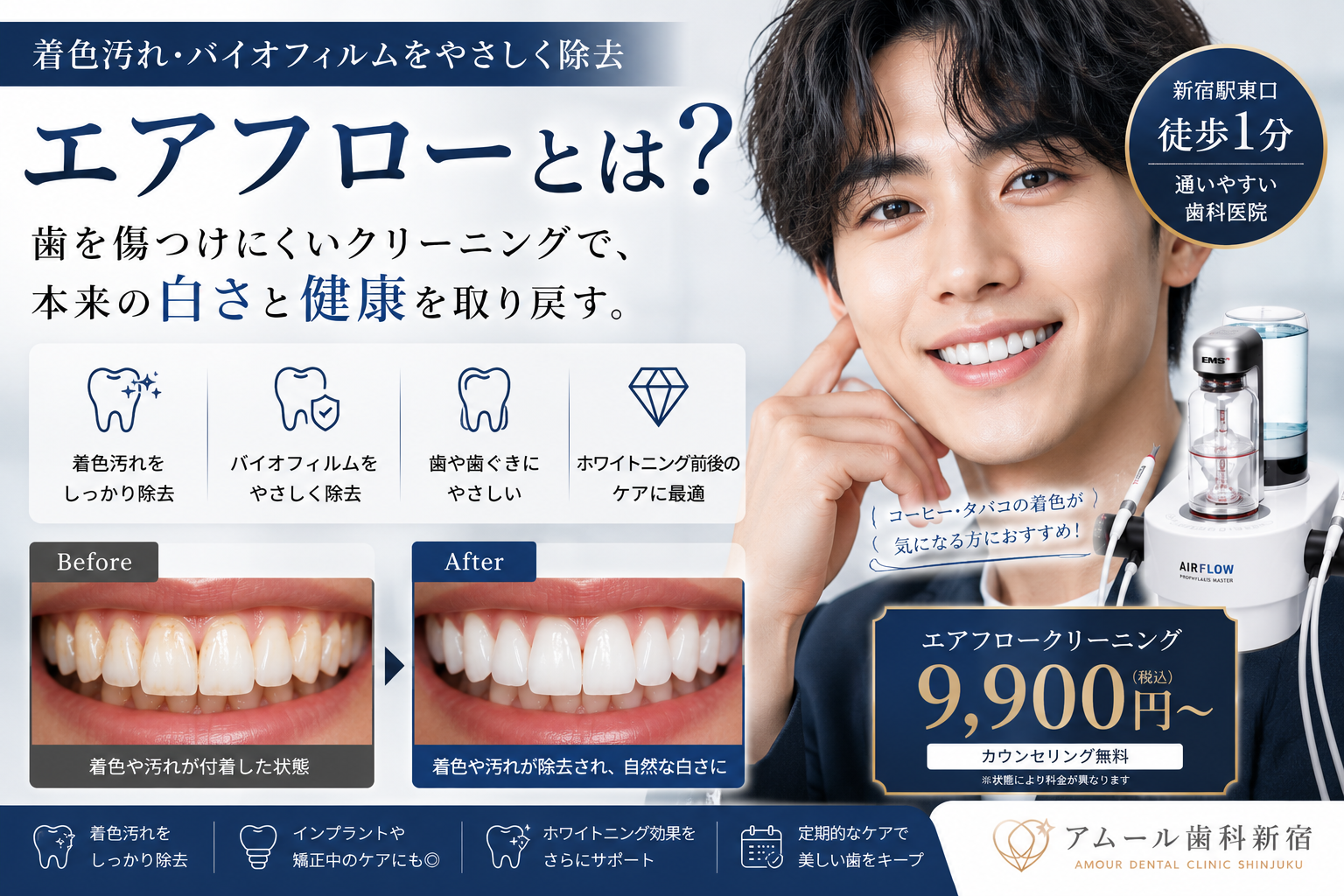 エアフローとは？歯の着色やバイオフィルムをやさしく除去するクリーニング｜アムール歯科新宿