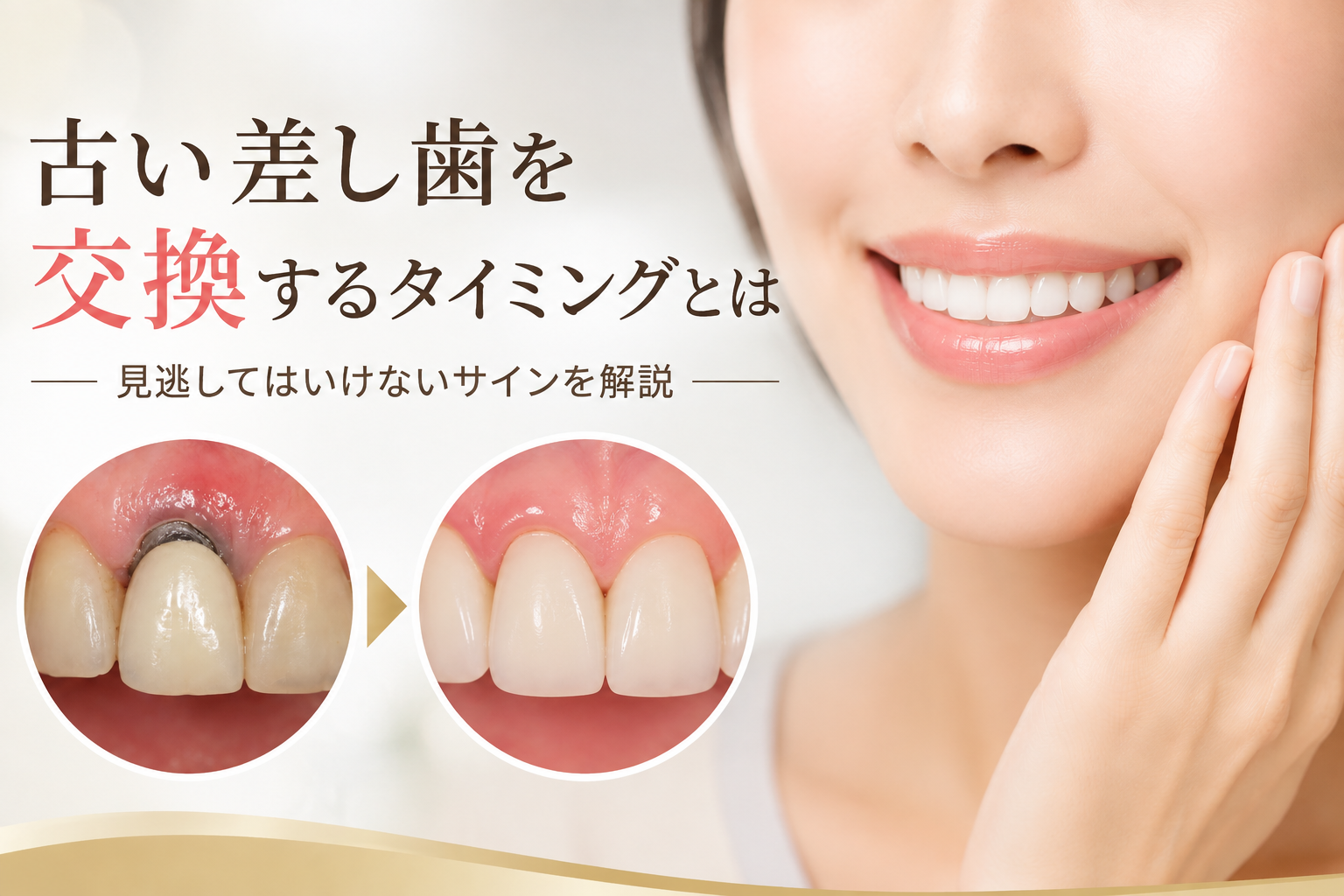 古い差し歯を交換するタイミングとは?見逃してはいけないサインを新宿の歯科医師が解説《アムール歯科新宿》