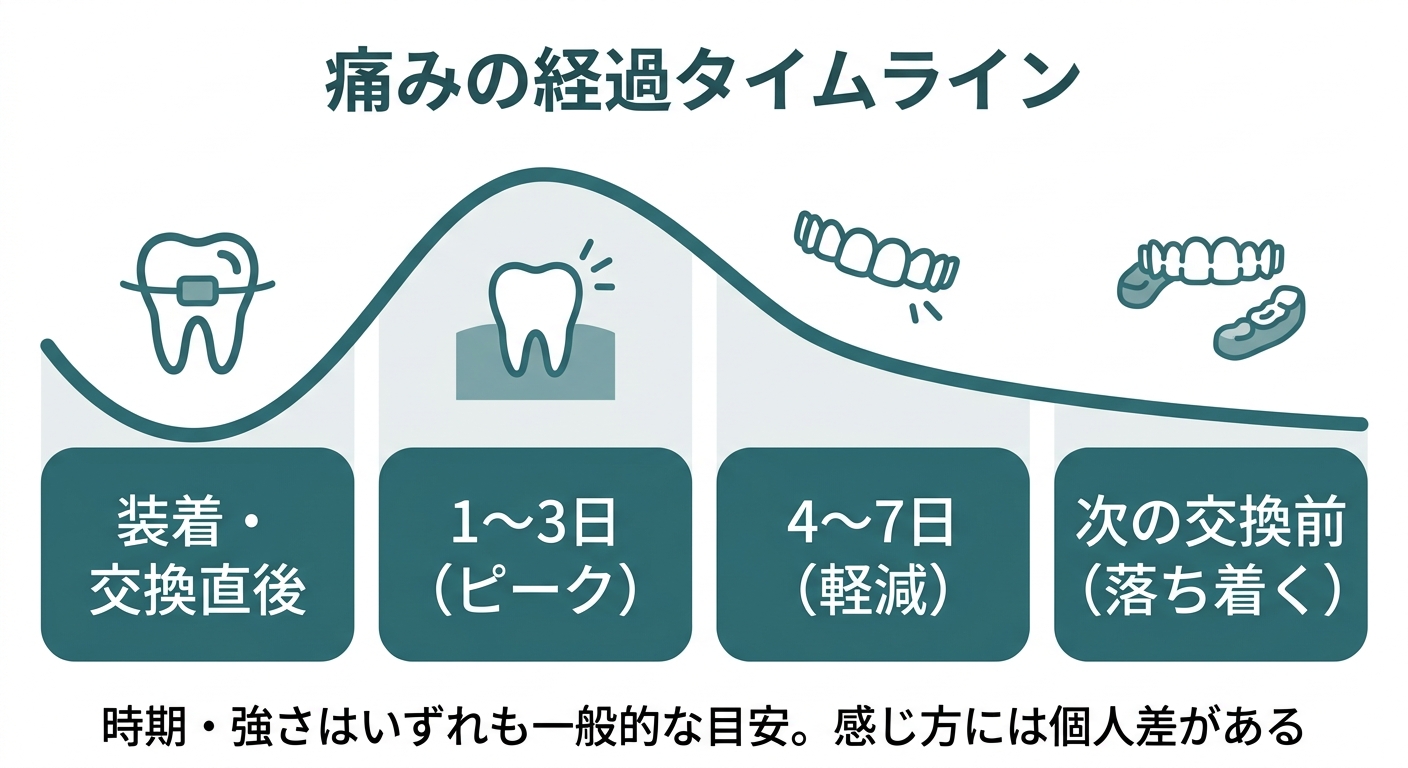 マウスピース矯正の痛みはいつまで続く？（正常な経過の目安）
